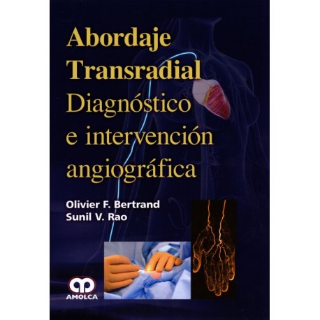 Abordaje Transradial Diagnóstico e intervención angiográfica - Envío Gratuito