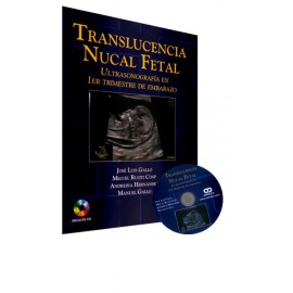 Translucencia Nucal Fetal - Envío Gratuito