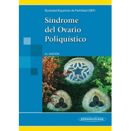 Síndrome del Ovario poliquístico - Envío Gratuito