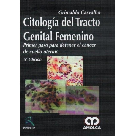 Citología del tracto genital femenino: Primer paso para detener el cáncer de cuello uterino - Envío Gratuito