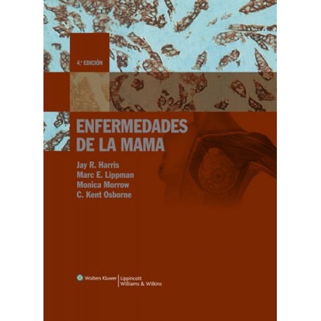 Enfermedades de la mama - Envío Gratuito