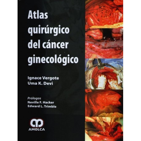 Atlas quirúrgico del cáncer ginecológico - Envío Gratuito