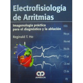 Electrofisiología de Arritmias - Envío Gratuito