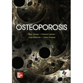 Osteoporosis - Envío Gratuito