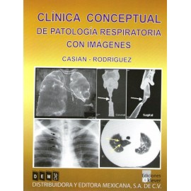 Clínica conceptual de patología respiratoria con imágenes - Envío Gratuito