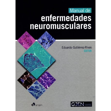 Manual de enfermedades neuromusculares - Envío Gratuito