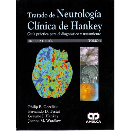 Tratado de Neurología Clínica de Hankey - Envío Gratuito