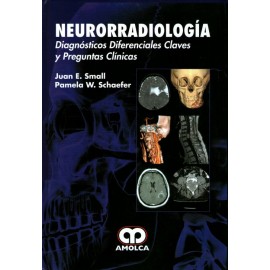 Neurorradiología - Envío Gratuito