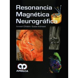 Resonancia Magnética Neurográfica - Envío Gratuito