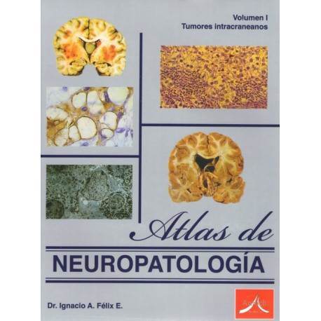 Atlas de neuropatología Vol. I: Tumores intracraneanos - Envío Gratuito