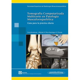Tomografía Computarizada Multicorte en Patología Musculoesquelética - Envío Gratuito