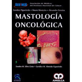 Mastología Oncológica - Envío Gratuito