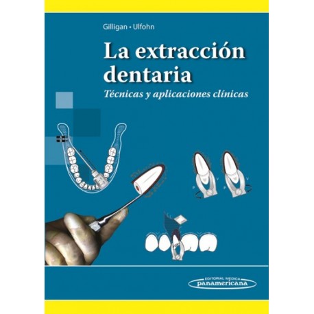 La extracción dentaria. Técnicas y aplicaciones clínicas - Envío Gratuito
