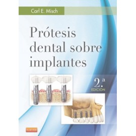 Prótesis dental sobre implantes - Envío Gratuito