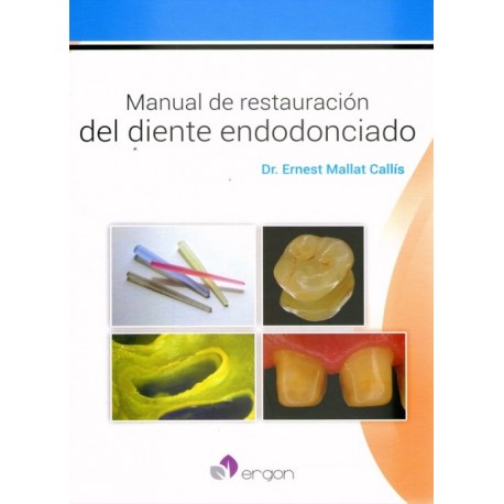 Manual de restauración del diente endodonciado - Envío Gratuito