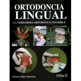 Ortodoncia lingual: La verdadera ortodoncia invisible - Envío Gratuito