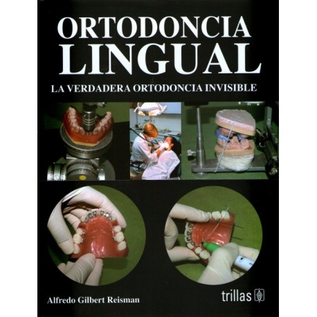 Ortodoncia lingual: La verdadera ortodoncia invisible - Envío Gratuito