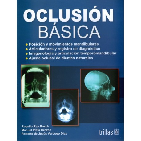 Oclusión básica - Envío Gratuito