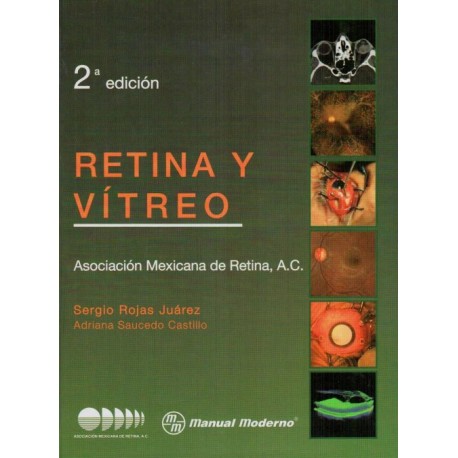 Retina y vítreo - Envío Gratuito