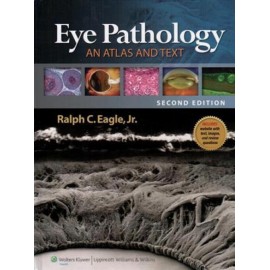 Eye pathology: An atlas and text - Envío Gratuito