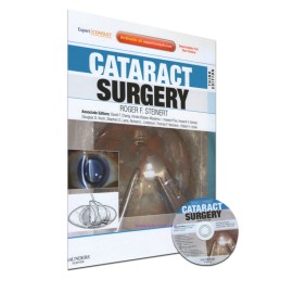 Cataract Surgery - Envío Gratuito