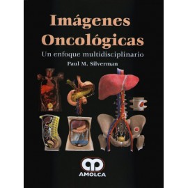 Imágenes Oncológicas. Un Enfoque Multidisciplinario - Envío Gratuito