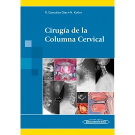 Cirugía de la Columna Cervical - Envío Gratuito