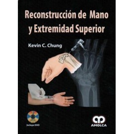 Reconstrucción de mano y extremidad superior - Envío Gratuito