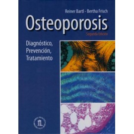 Osteoporosis: diagnóstico, prevención, tratamiento - Envío Gratuito
