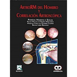 ArtroRM del hombro y correlación artroscópica - Envío Gratuito