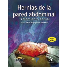 Hernias de la pared abdominal - Envío Gratuito