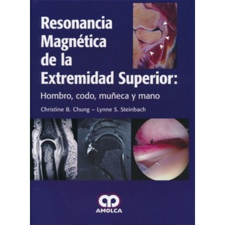 Resonancia magnética de la extremidad superior: Hombro, codo, muñeca y mano - Envío Gratuito