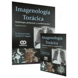 Imagenología Torácica Radiología pulmonar y cardiovascular 2 Volumenes - Envío Gratuito