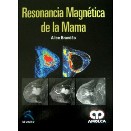 Resonancia Magnética de la Mama - Envío Gratuito