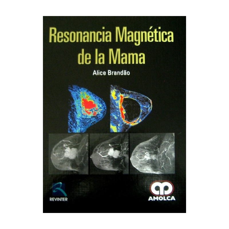 Resonancia Magnética De La Mama