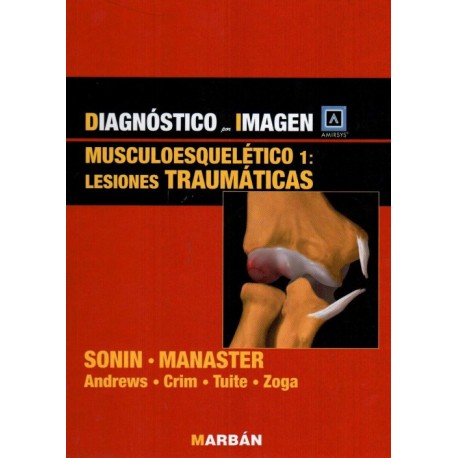 Diagnóstico por imagen: Musculoesqueletico 1. Lesiones traumáticas - Envío Gratuito