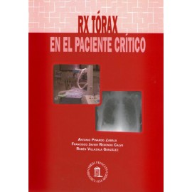 RX tórax en el paciente crítico - Envío Gratuito