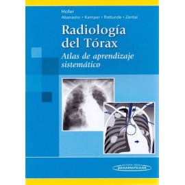 Radiología del tórax: atlas de aprendizaje sistemático - Envío Gratuito