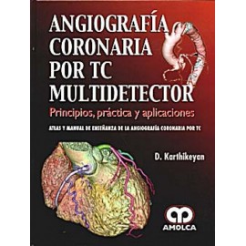 Angiografía coronaria por TC multidetector. Principios, práctica y aplicaciones - Envío Gratuito