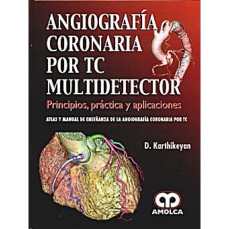 Angiografía coronaria por TC multidetector. Principios, práctica y aplicaciones - Envío Gratuito