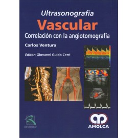 Ultrasonografía Vascular Correlación con la Angiotomografía - Envío Gratuito