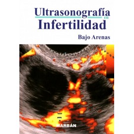 Ultrasonografía en infertilidad - Envío Gratuito
