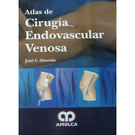 Atlas de Cirugía Endovascular Venosa - Envío Gratuito