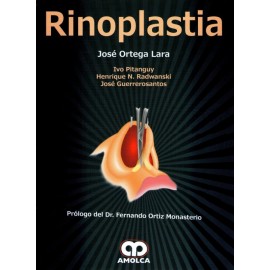 Rinoplastia - Envío Gratuito