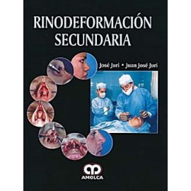 Rinodeformación Secundaria - Envío Gratuito