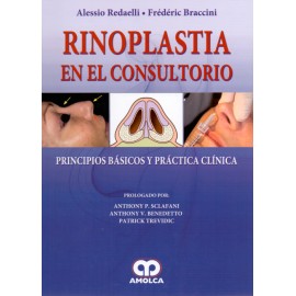 Rinoplastia en el Consultorio - Envío Gratuito