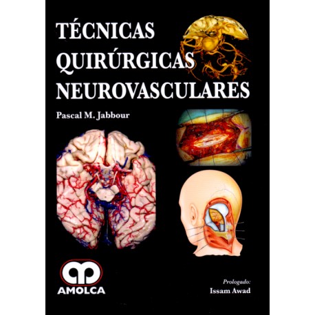 Técnicas quirúrgicas neurovasculares - Envío Gratuito