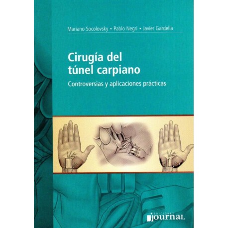 Cirugia del Tunel Carpiano, Controversias y aplicaciones practicas - Envío Gratuito
