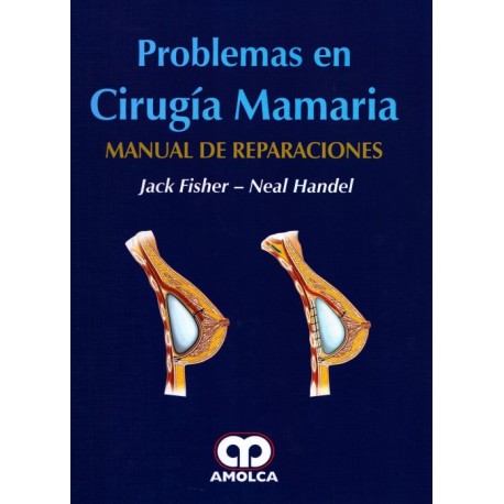 Problemas en Cirugía Mamaria. Manual de reparaciones Amolca - Envío Gratuito