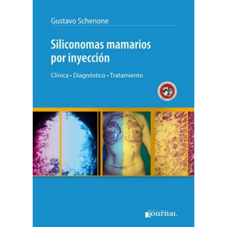 Siliconomas mamarios por inyección Journal - Envío Gratuito